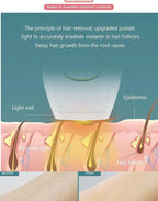 IPL Laser Ontharing - Professioneel Thuisapparaat