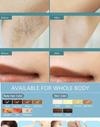 IPL Laser Ontharing - Professioneel Thuisapparaat