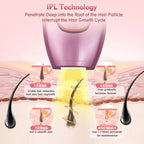 IPL Laser Ontharing - Professioneel Thuisapparaat